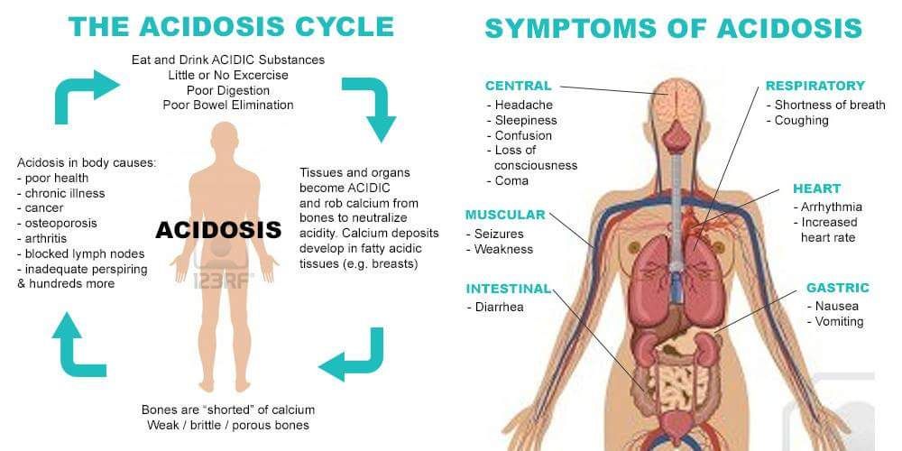 acidosis 